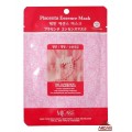 805455_MJ Care Маска-салфетка для лица с плацентой
